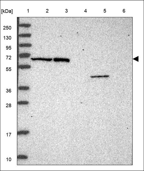Lane 1: Marker [kDa] 250,130,95,72,55,36,28,17,10 Lane 2: RT4 Lane 3: U-251 MG Lane 4: Human Plasma Lane 5: Liver Lane 6: Tonsil