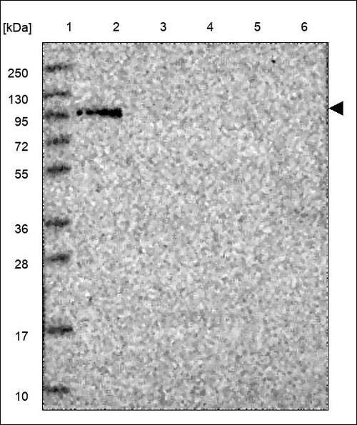 Lane 1: Marker [kDa] 250,130,95,72,55,36,28,17,10 Lane 2: RT4 Lane 3: U-251 MG Lane 4: Human Plasma Lane 5: Liver Lane 6: Tonsil