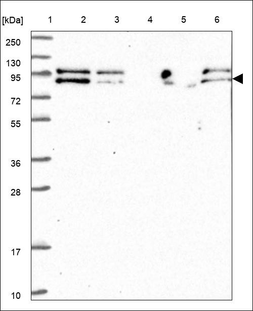 Lane 1: Marker [kDa] 250,130,95,72,55,36,28,17,10 Lane 2: RT4 Lane 3: U-251 MG Lane 4: Human Plasma Lane 5: Liver Lane 6: Tonsil