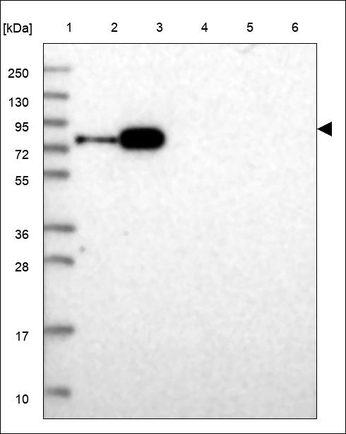 Lane 1: Marker [kDa] 250,130,95,72,55,36,28,17,10 Lane 2: RT4 Lane 3: U-251 MG Lane 4: Human Plasma Lane 5: Liver Lane 6: Tonsil