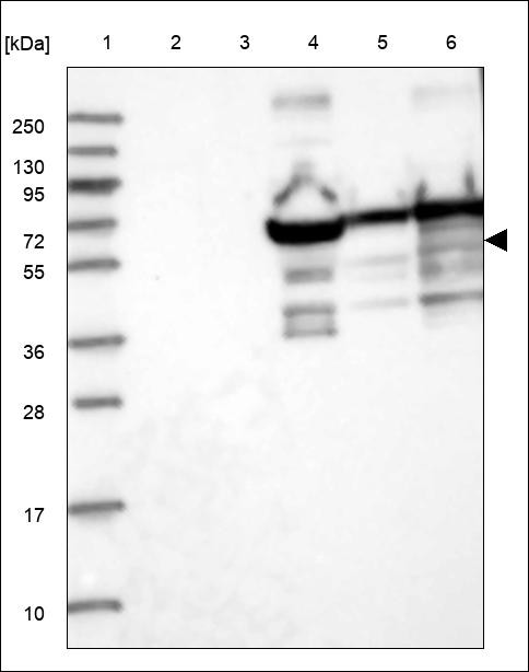Lane 1: Marker [kDa] 250,130,95,72,55,36,28,17,10 Lane 2: RT4 Lane 3: U-251 MG Lane 4: Human Plasma Lane 5: Liver Lane 6: Tonsil
