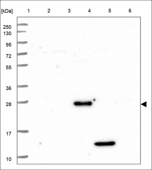 Lane 1: Marker [kDa] 250,130,95,72,55,36,28,17,10 Lane 2: RT4 Lane 3: U-251 MG Lane 4: Human Plasma Lane 5: Liver Lane 6: Tonsil