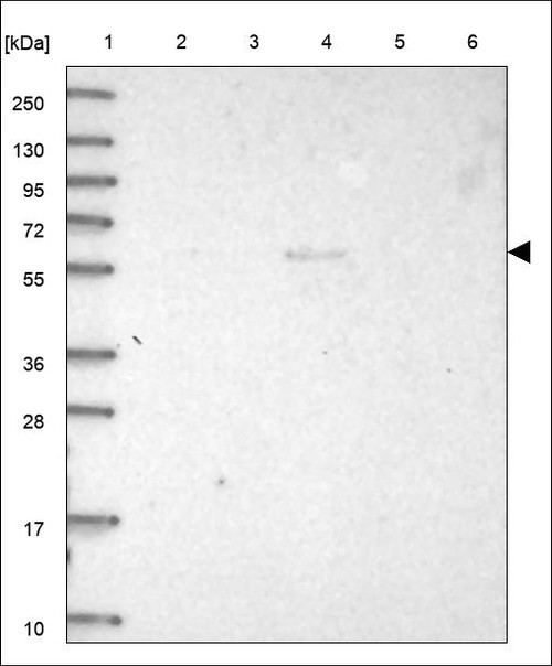 Lane 1: Marker [kDa] 250,130,95,72,55,36,28,17,10 Lane 2: RT4 Lane 3: U-251 MG Lane 4: Human Plasma Lane 5: Liver Lane 6: Tonsil