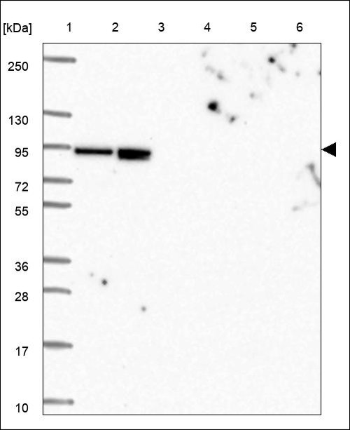 Lane 1: Marker [kDa] 250,130,95,72,55,36,28,17,10 Lane 2: RT4 Lane 3: U-251 MG Lane 4: Human Plasma Lane 5: Liver Lane 6: Tonsil