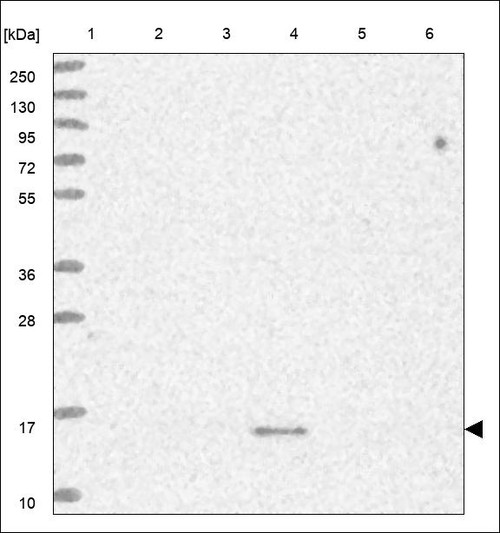 Lane 1: Marker [kDa] 250,130,95,72,55,36,28,17,10 Lane 2: RT4 Lane 3: U-251 MG Lane 4: Human Plasma Lane 5: Liver Lane 6: Tonsil