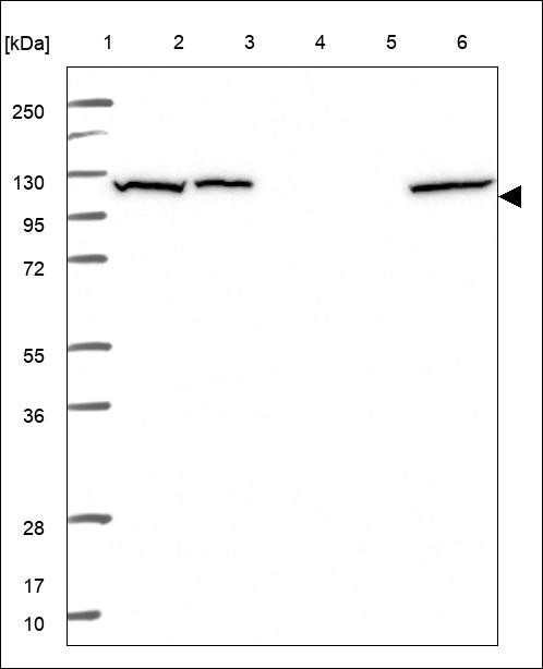 Lane 1: Marker [kDa] 250,130,95,72,55,36,28,17,10 Lane 2: RT4 Lane 3: U-251 MG Lane 4: Human Plasma Lane 5: Liver Lane 6: Tonsil