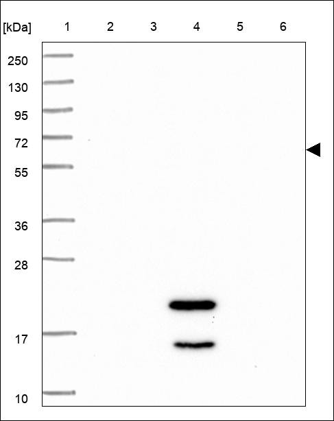 Lane 1: Marker [kDa] 250,130,95,72,55,36,28,17,10 Lane 2: RT4 Lane 3: U-251 MG Lane 4: Human Plasma Lane 5: Liver Lane 6: Tonsil