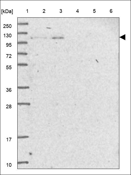 Lane 1: Marker [kDa] 250,130,95,72,55,36,28,17,10 Lane 2: RT4 Lane 3: U-251 MG Lane 4: Human Plasma Lane 5: Liver Lane 6: Tonsil