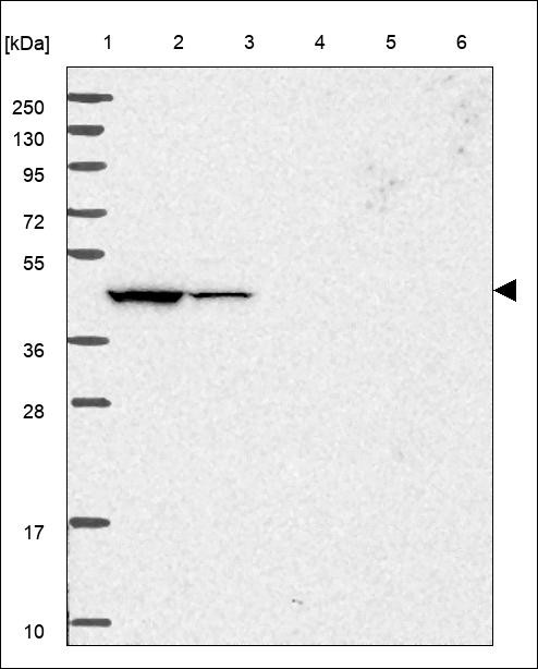 Lane 1: Marker [kDa] 250,130,95,72,55,36,28,17,10 Lane 2: RT4 Lane 3: U-251 MG Lane 4: Human Plasma Lane 5: Liver Lane 6: Tonsil