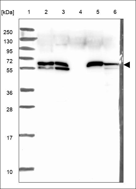 Lane 1: Marker [kDa] 250,130,95,72,55,36,28,17,10 Lane 2: RT4 Lane 3: U-251 MG Lane 4: Human Plasma Lane 5: Liver Lane 6: Tonsil