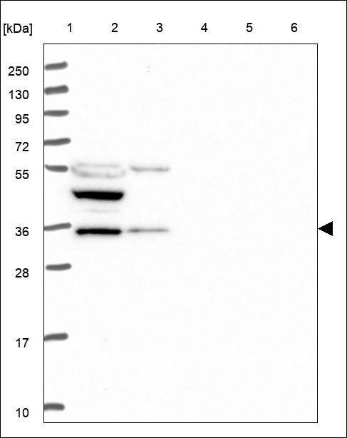 Lane 1: Marker [kDa] 250,130,95,72,55,36,28,17,10 Lane 2: RT4 Lane 3: U-251 MG Lane 4: Human Plasma Lane 5: Liver Lane 6: Tonsil