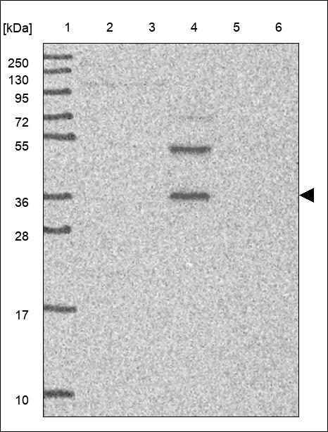 Lane 1: Marker [kDa] 250,130,95,72,55,36,28,17,10 Lane 2: RT4 Lane 3: U-251 MG Lane 4: Human Plasma Lane 5: Liver Lane 6: Tonsil