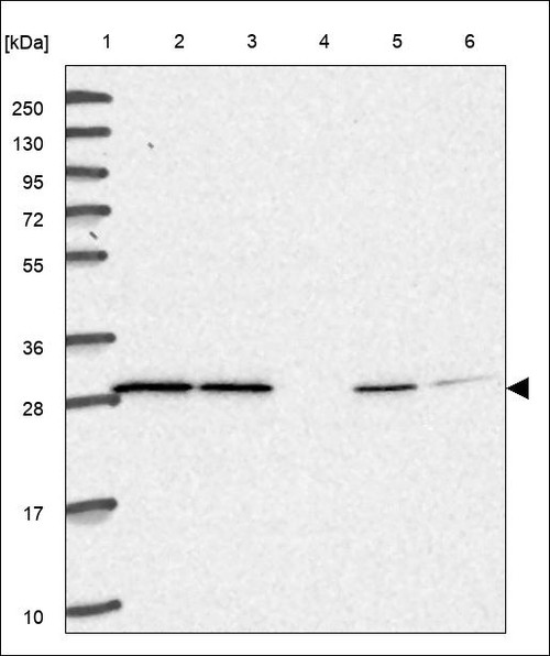 Lane 1: Marker [kDa] 250,130,95,72,55,36,28,17,10 Lane 2: RT4 Lane 3: U-251 MG Lane 4: Human Plasma Lane 5: Liver Lane 6: Tonsil