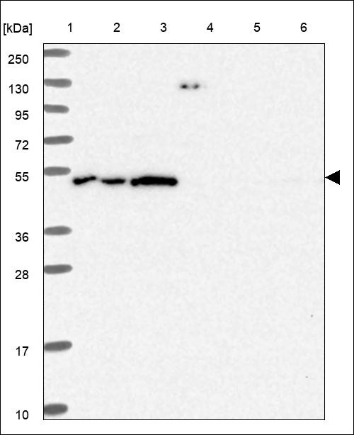 Lane 1: Marker [kDa] 250,130,95,72,55,36,28,17,10 Lane 2: RT4 Lane 3: U-251 MG Lane 4: Human Plasma Lane 5: Liver Lane 6: Tonsil