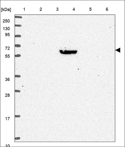 Lane 1: Marker [kDa] 250,130,95,72,55,36,28,17,10 Lane 2: RT4 Lane 3: U-251 MG Lane 4: Human Plasma Lane 5: Liver Lane 6: Tonsil