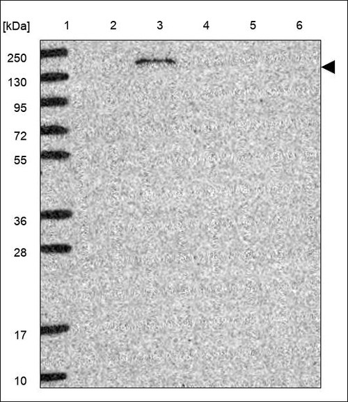 Lane 1: Marker [kDa] 250,130,95,72,55,36,28,17,10 Lane 2: RT4 Lane 3: U-251 MG Lane 4: Human Plasma Lane 5: Liver Lane 6: Tonsil