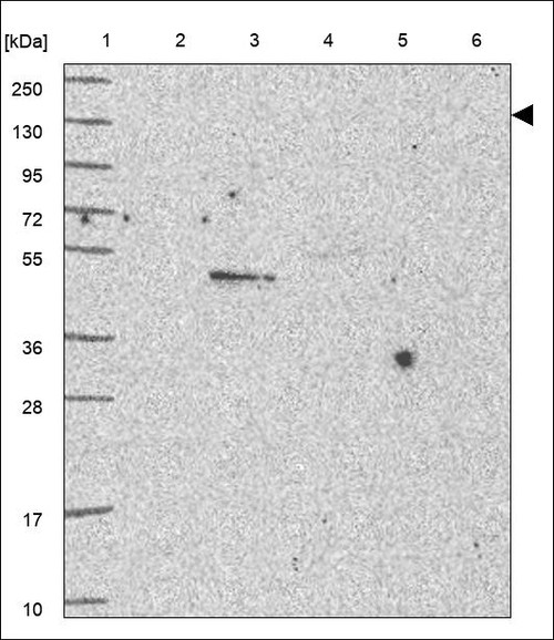 Lane 1: Marker [kDa] 250,130,95,72,55,36,28,17,10 Lane 2: RT4 Lane 3: U-251 MG Lane 4: Human Plasma Lane 5: Liver Lane 6: Tonsil
