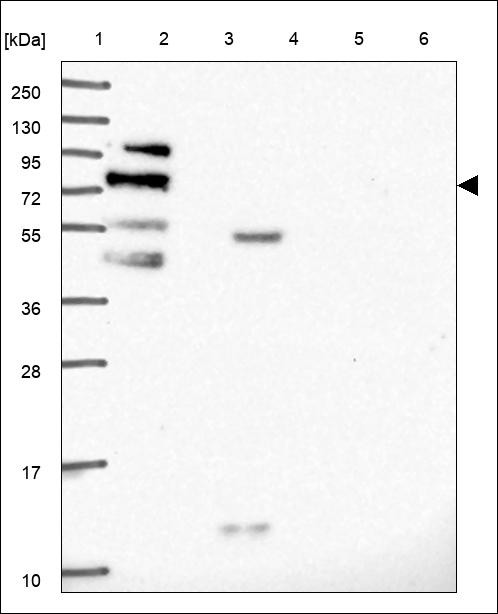 Lane 1: Marker [kDa] 250,130,95,72,55,36,28,17,10 Lane 2: RT4 Lane 3: U-251 MG Lane 4: Human Plasma Lane 5: Liver Lane 6: Tonsil