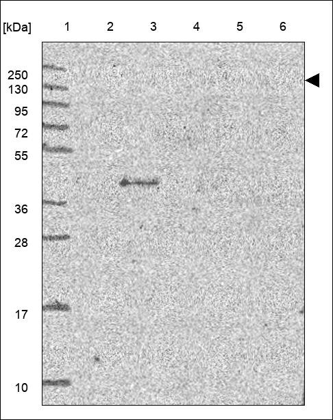 Lane 1: Marker [kDa] 250,130,95,72,55,36,28,17,10 Lane 2: RT4 Lane 3: U-251 MG Lane 4: Human Plasma Lane 5: Liver Lane 6: Tonsil
