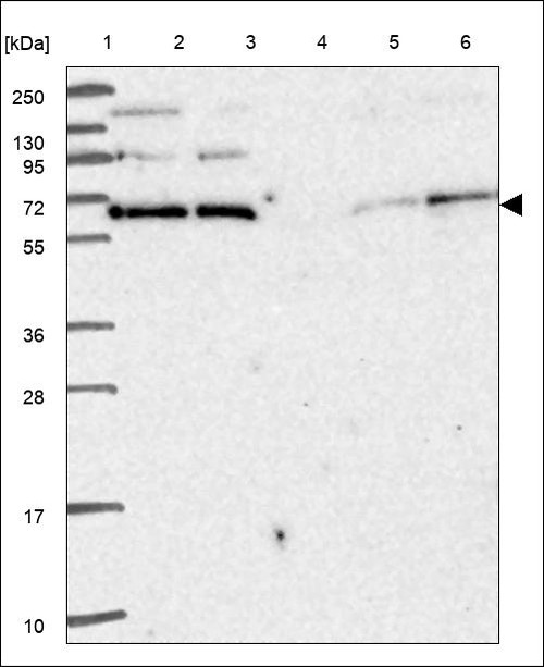 Lane 1: Marker [kDa] 250,130,95,72,55,36,28,17,10 Lane 2: RT4 Lane 3: U-251 MG Lane 4: Human Plasma Lane 5: Liver Lane 6: Tonsil