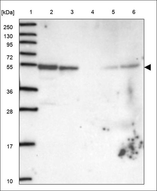 Lane 1: Marker [kDa] 250,130,95,72,55,36,28,17,10 Lane 2: RT4 Lane 3: U-251 MG Lane 4: Human Plasma Lane 5: Liver Lane 6: Tonsil