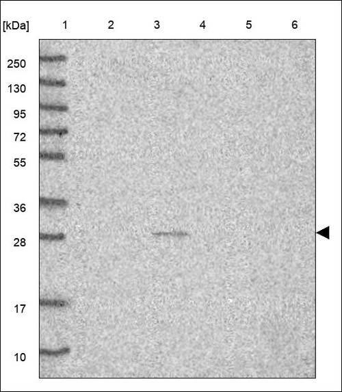 Lane 1: Marker [kDa] 250,130,95,72,55,36,28,17,10 Lane 2: RT4 Lane 3: U-251 MG Lane 4: Human Plasma Lane 5: Liver Lane 6: Tonsil