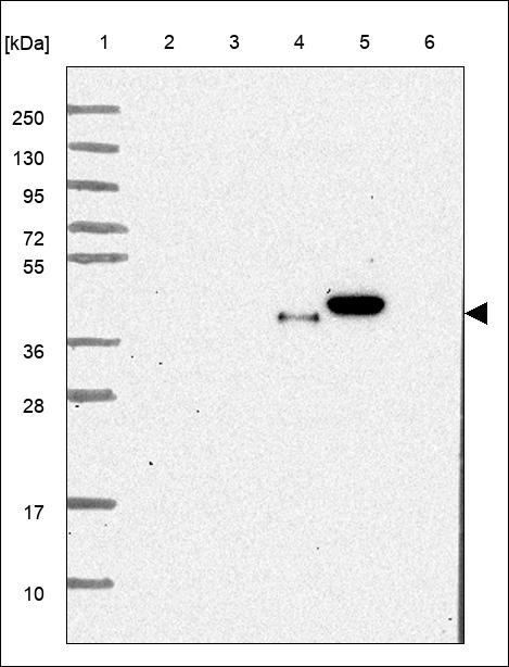 Lane 1: Marker [kDa] 250,130,95,72,55,36,28,17,10 Lane 2: RT4 Lane 3: U-251 MG Lane 4: Human Plasma Lane 5: Liver Lane 6: Tonsil