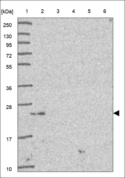 Lane 1: Marker [kDa] 250,130,95,72,55,36,28,17,10 Lane 2: RT4 Lane 3: U-251 MG Lane 4: Human Plasma Lane 5: Liver Lane 6: Tonsil