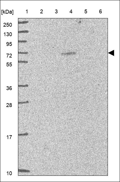 Lane 1: Marker [kDa] 250,130,95,72,55,36,28,17,10 Lane 2: RT4 Lane 3: U-251 MG Lane 4: Human Plasma Lane 5: Liver Lane 6: Tonsil