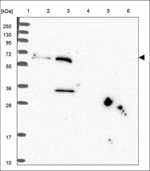 Lane 1: Marker [kDa] 250,130,95,72,55,36,28,17,10 Lane 2: RT4 Lane 3: U-251 MG Lane 4: Human Plasma Lane 5: Liver Lane 6: Tonsil