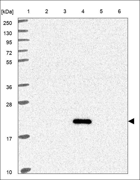 Lane 1: Marker [kDa] 250,130,95,72,55,36,28,17,10 Lane 2: RT4 Lane 3: U-251 MG Lane 4: Human Plasma Lane 5: Liver Lane 6: Tonsil