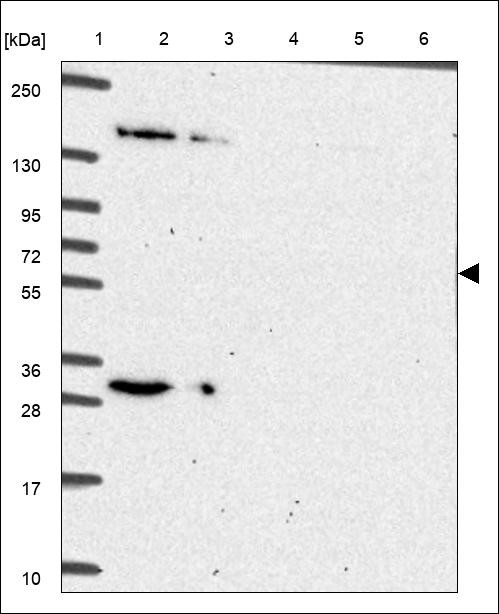 Lane 1: Marker [kDa] 250,130,95,72,55,36,28,17,10 Lane 2: RT4 Lane 3: U-251 MG Lane 4: Human Plasma Lane 5: Liver Lane 6: Tonsil