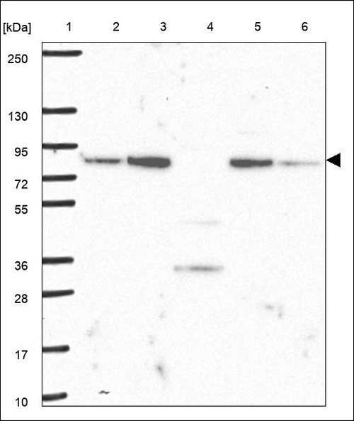 Lane 1: Marker [kDa] 250,130,95,72,55,36,28,17,10 Lane 2: RT4 Lane 3: U-251 MG Lane 4: Human Plasma Lane 5: Liver Lane 6: Tonsil