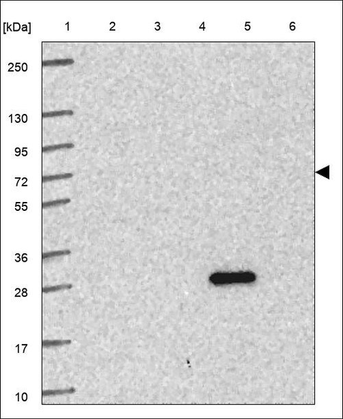 Lane 1: Marker [kDa] 250,130,95,72,55,36,28,17,10 Lane 2: RT4 Lane 3: U-251 MG Lane 4: Human Plasma Lane 5: Liver Lane 6: Tonsil