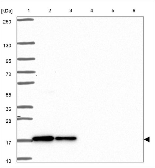 Lane 1: Marker [kDa] 250,130,95,72,55,36,28,17,10 Lane 2: RT4 Lane 3: U-251 MG Lane 4: Human Plasma Lane 5: Liver Lane 6: Tonsil