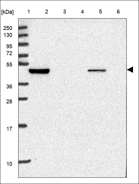 Lane 1: Marker [kDa] 250,130,95,72,55,36,28,17,10 Lane 2: RT4 Lane 3: U-251 MG Lane 4: Human Plasma Lane 5: Liver Lane 6: Tonsil
