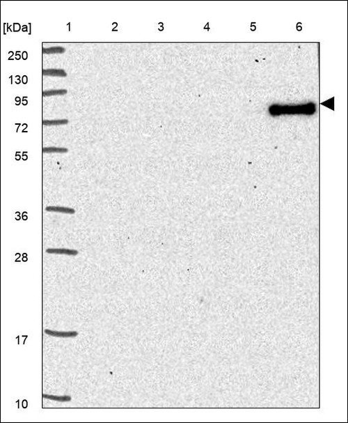 Lane 1: Marker [kDa] 250,130,95,72,55,36,28,17,10 Lane 2: RT4 Lane 3: U-251 MG Lane 4: Human Plasma Lane 5: Liver Lane 6: Tonsil
