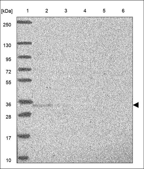 Lane 1: Marker [kDa] 250,130,95,72,55,36,28,17,10 Lane 2: RT4 Lane 3: U-251 MG Lane 4: Human Plasma Lane 5: Liver Lane 6: Tonsil