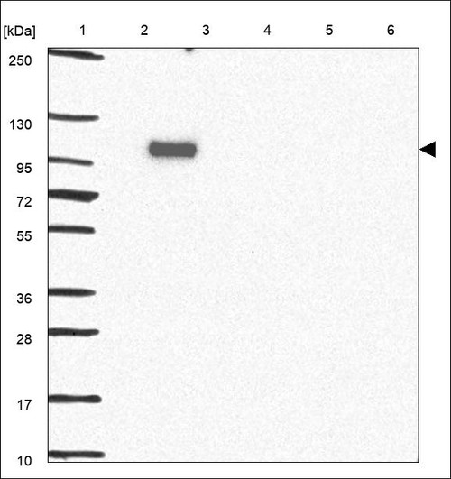 Lane 1: Marker [kDa] 250,130,95,72,55,36,28,17,10 Lane 2: RT4 Lane 3: U-251 MG Lane 4: Human Plasma Lane 5: Liver Lane 6: Tonsil