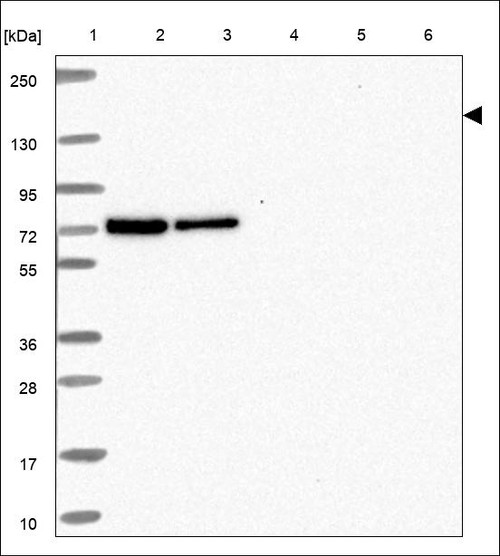 Lane 1: Marker [kDa] 250,130,95,72,55,36,28,17,10 Lane 2: RT4 Lane 3: U-251 MG Lane 4: Human Plasma Lane 5: Liver Lane 6: Tonsil