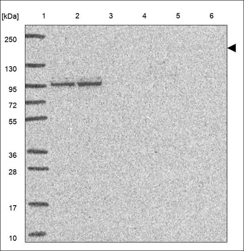 Lane 1: Marker [kDa] 250,130,95,72,55,36,28,17,10 Lane 2: RT4 Lane 3: U-251 MG Lane 4: Human Plasma Lane 5: Liver Lane 6: Tonsil