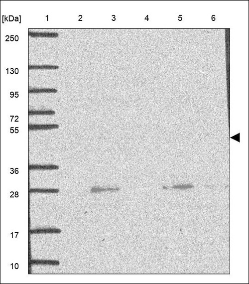 Lane 1: Marker [kDa] 250,130,95,72,55,36,28,17,10 Lane 2: RT4 Lane 3: U-251 MG Lane 4: Human Plasma Lane 5: Liver Lane 6: Tonsil
