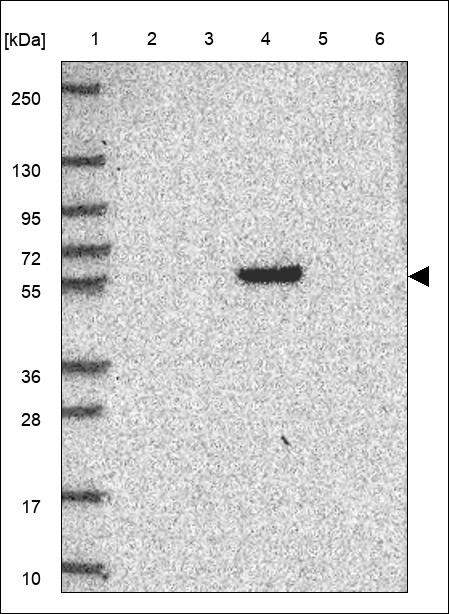 Lane 1: Marker [kDa] 250,130,95,72,55,36,28,17,10 Lane 2: RT4 Lane 3: U-251 MG Lane 4: Human Plasma Lane 5: Liver Lane 6: Tonsil