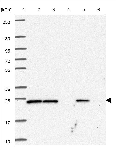 Lane 1: Marker [kDa] 250,130,95,72,55,36,28,17,10 Lane 2: RT4 Lane 3: U-251 MG Lane 4: Human Plasma Lane 5: Liver Lane 6: Tonsil