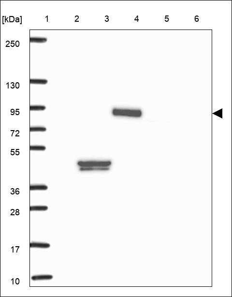 Lane 1: Marker [kDa] 250,130,95,72,55,36,28,17,10 Lane 2: RT4 Lane 3: U-251 MG Lane 4: Human Plasma Lane 5: Liver Lane 6: Tonsil