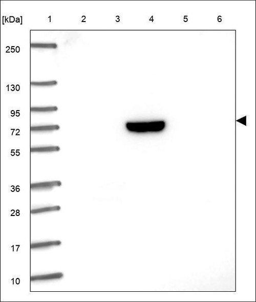 Lane 1: Marker [kDa] 250,130,95,72,55,36,28,17,10 Lane 2: RT4 Lane 3: U-251 MG Lane 4: Human Plasma Lane 5: Liver Lane 6: Tonsil