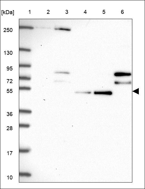 Lane 1: Marker [kDa] 250,130,95,72,55,36,28,17,10 Lane 2: RT4 Lane 3: U-251 MG Lane 4: Human Plasma Lane 5: Liver Lane 6: Tonsil