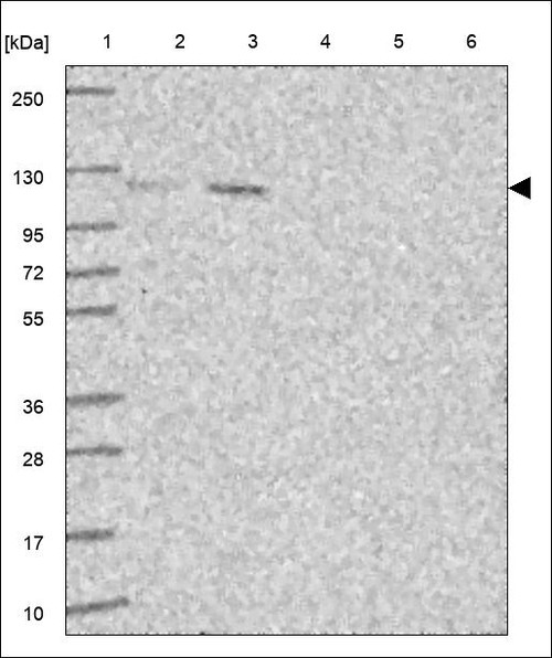 Lane 1: Marker [kDa] 250,130,95,72,55,36,28,17,10 Lane 2: RT4 Lane 3: U-251 MG Lane 4: Human Plasma Lane 5: Liver Lane 6: Tonsil