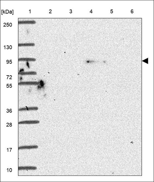 Lane 1: Marker [kDa] 250,130,95,72,55,36,28,17,10 Lane 2: RT4 Lane 3: U-251 MG Lane 4: Human Plasma Lane 5: Liver Lane 6: Tonsil