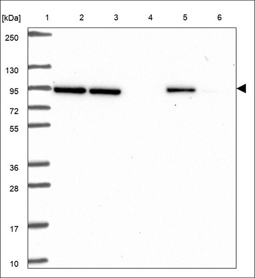 Lane 1: Marker [kDa] 250,130,95,72,55,36,28,17,10 Lane 2: RT4 Lane 3: U-251 MG Lane 4: Human Plasma Lane 5: Liver Lane 6: Tonsil